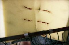 [VIDE]