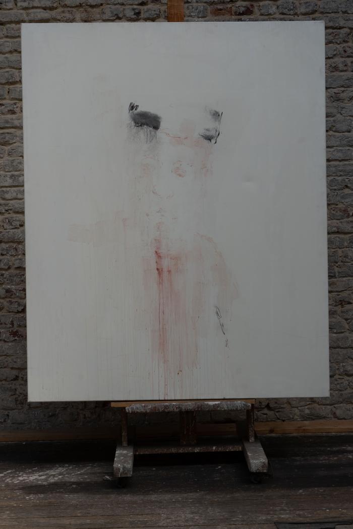 [VIDE]